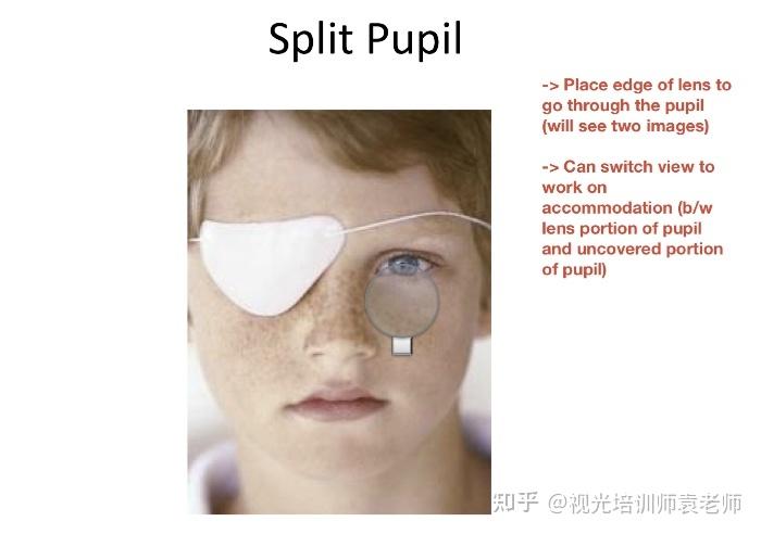 split pupil into two