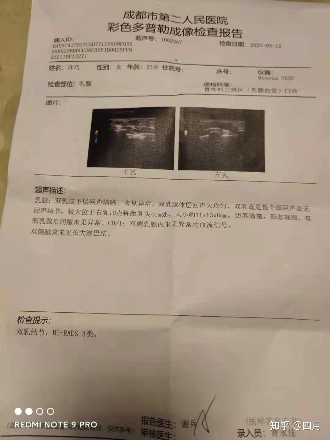 良医二乳腺纤维瘤