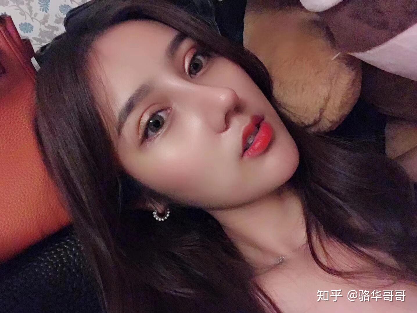 芭比眼综合肋软骨鼻综合了解一下