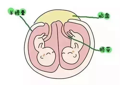 好奇宝宝篇让漫画来告诉你双胞胎的形成过程