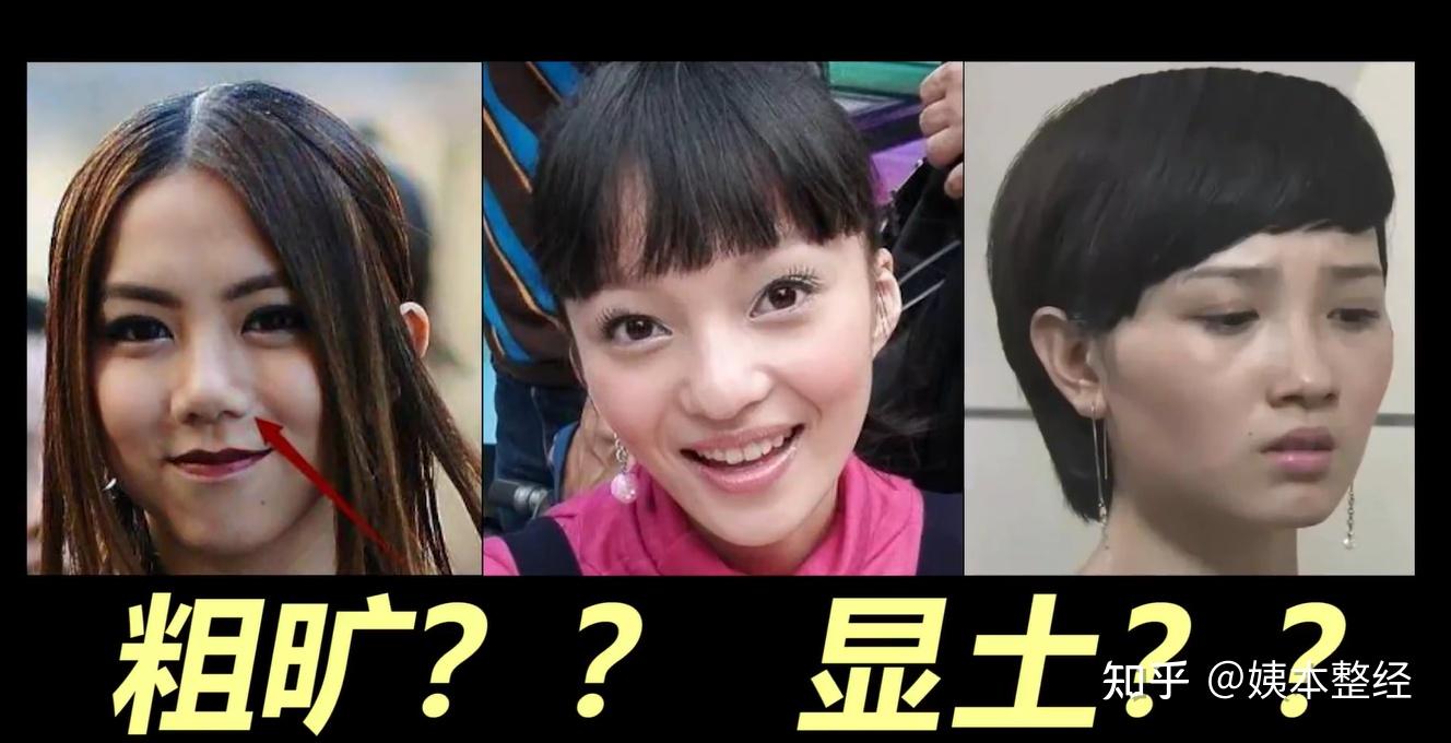 蒜头鼻学会这四招希望可以很好看