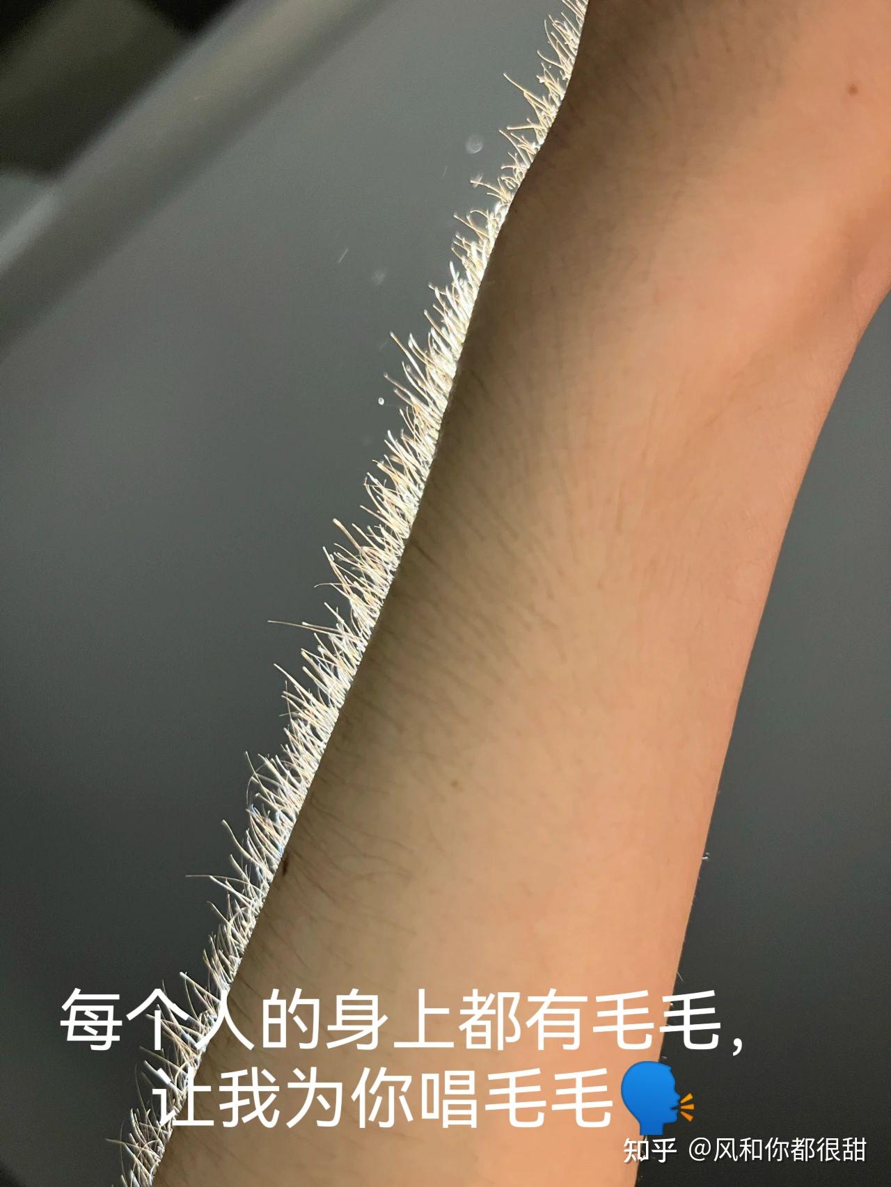 menemoy鸡皮肤脖子的简单介绍