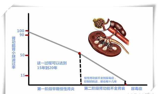 慢性肾炎"到"尿毒症,经过两个阶段,把握好就能逃过尿毒症 - 知乎