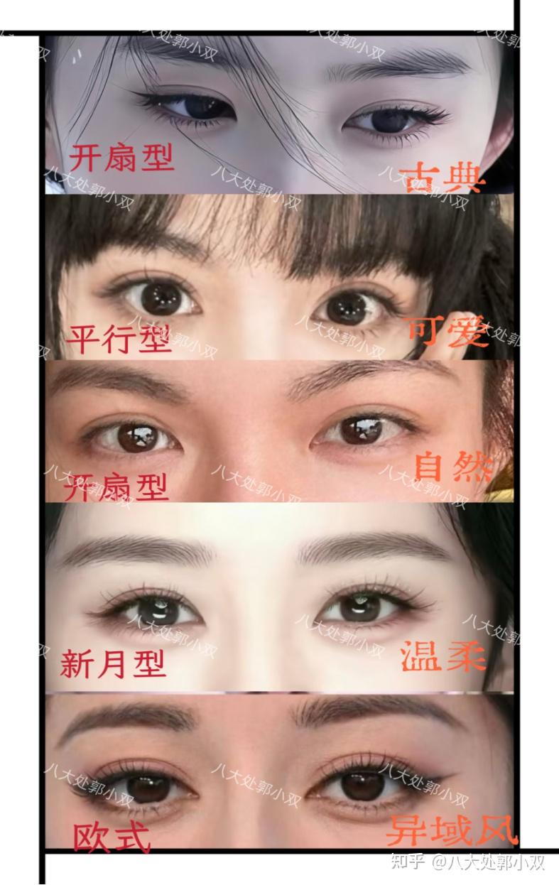 双眼皮知识全解 - 知乎
