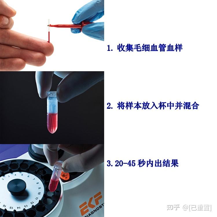 德国ekfbiosencline进口便携式葡萄糖乳酸分析仪