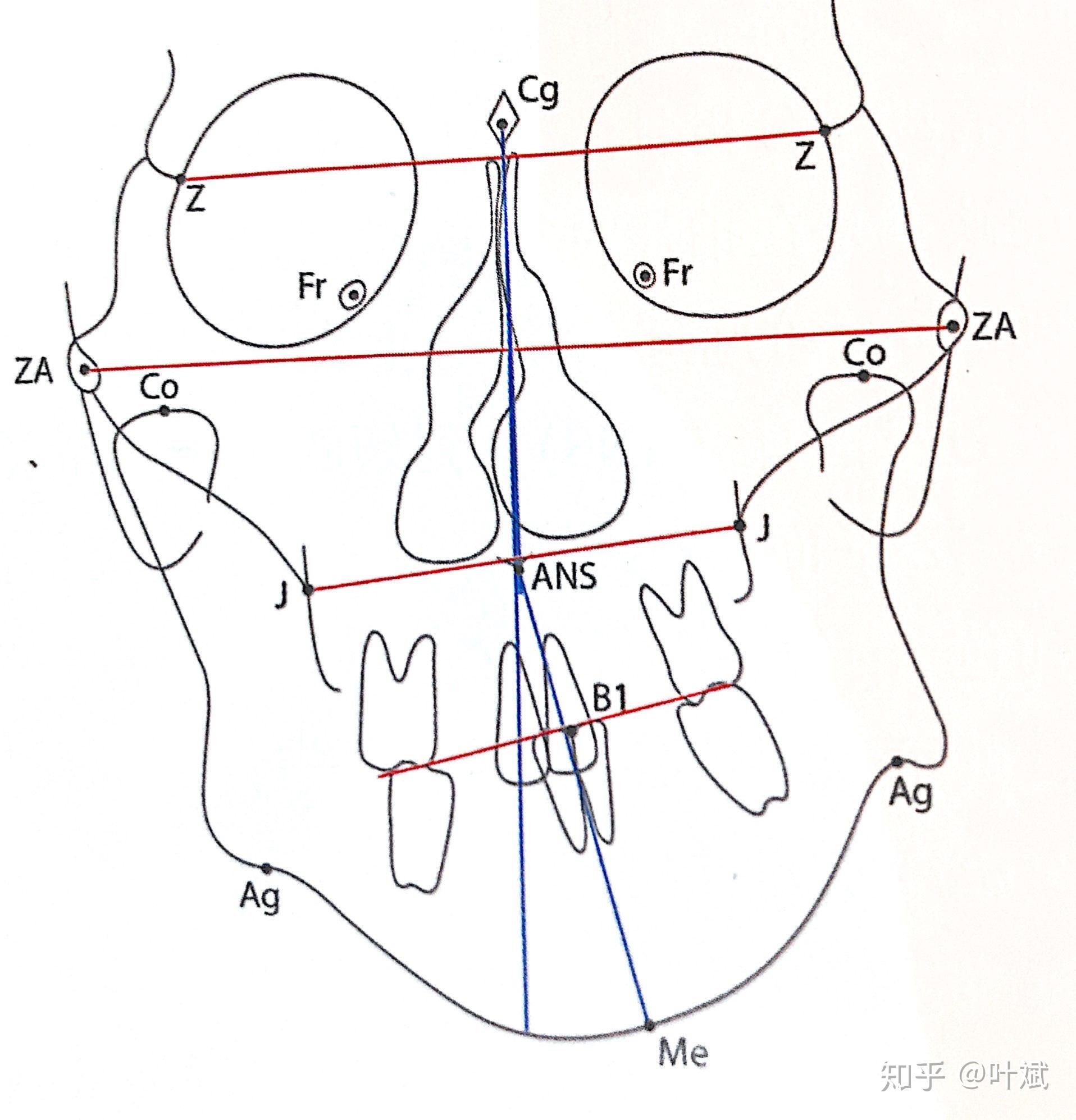 1,骨骼不對稱和麵部比例分析.