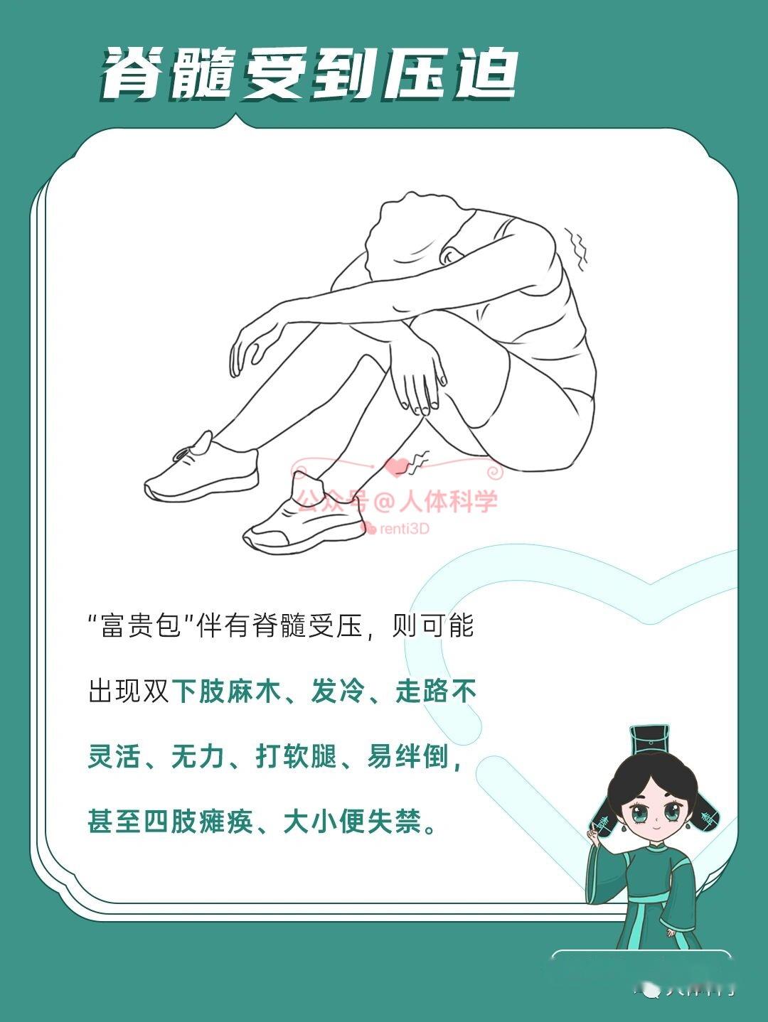 14什么是富贵包14"富贵包"指的是在后背上部颈