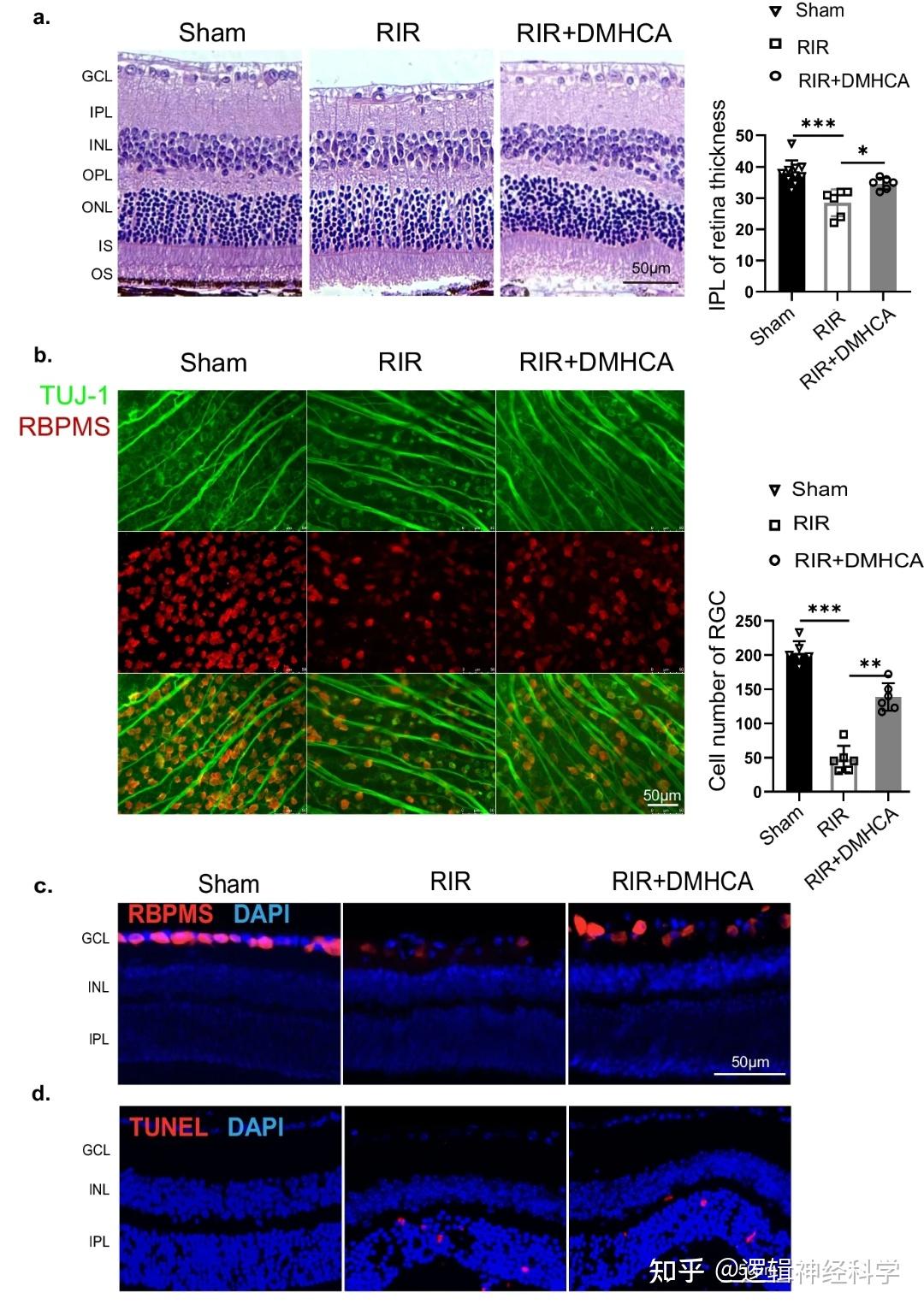 J Neuroinflammation︱中山大学卓业鸿/苏文如团队揭示DMHCA或可有效减轻视网膜缺血/再灌注损伤中神经元死亡和视网膜炎症 - 知乎