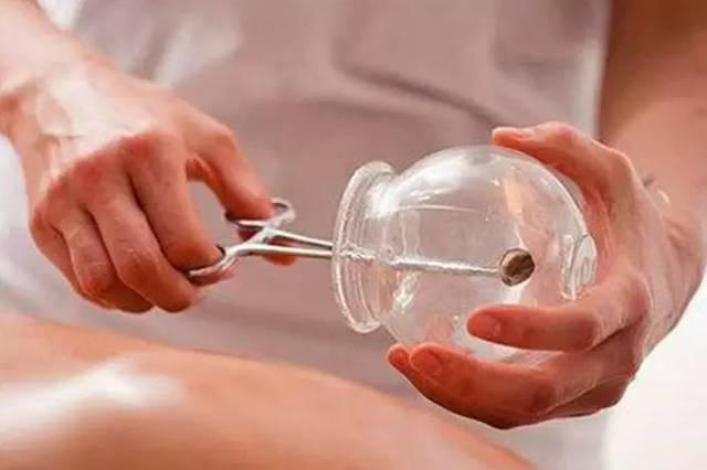 拔罐到底能治多少病