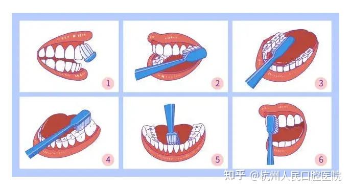 巴斯(bass)刷牙法_杭州人民口腔医院