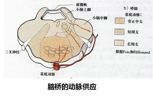 小腦上動脈綜合徵小腦上動脈閉塞後損害了腦橋外側的結合臂,脊髓丘束