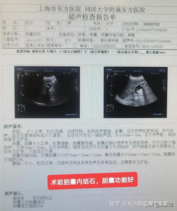 射胆猎手专家专栏图片