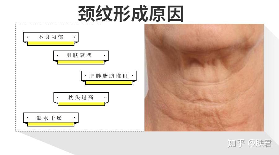 脸那么美别让颈纹拖了腿颈纹一出老10岁保养也要雨露均沾