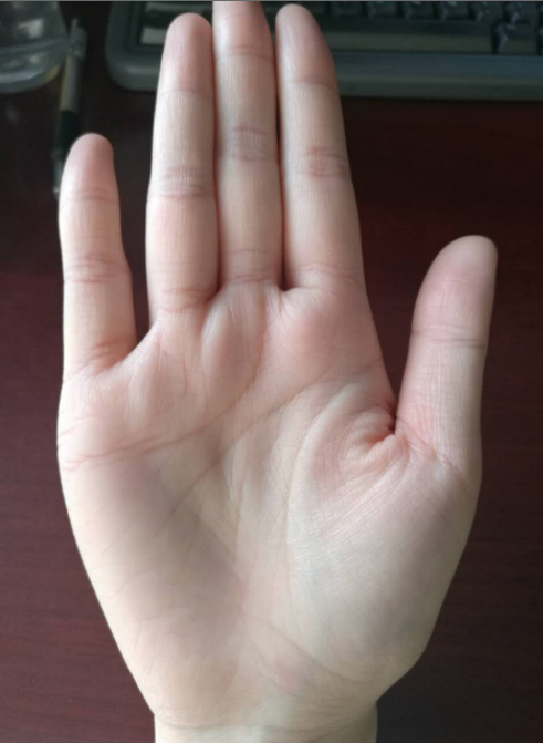 川字掌 掌色红为性格冲动 - 知乎