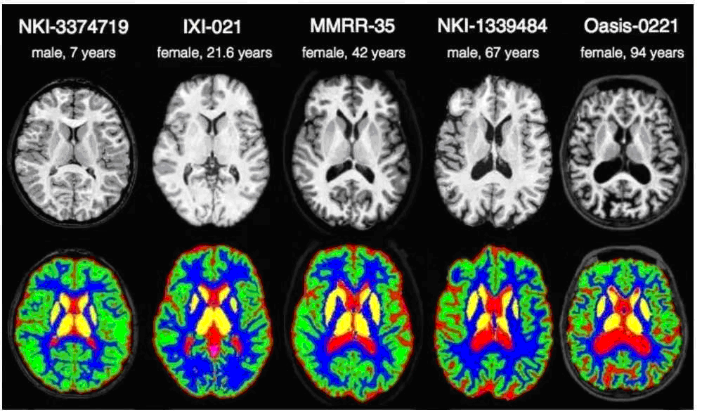 对基于深度学习的医学图像分割的一些理解