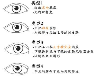 v2-2c2469e9608058cd4416ea8d34e14a5b_b.jpg