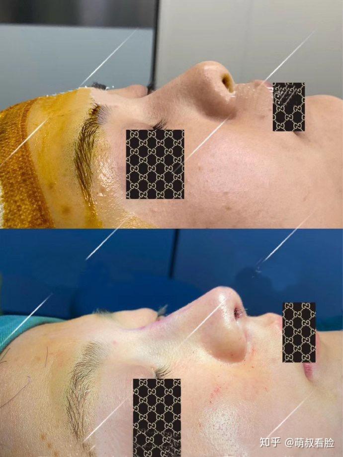 v2-2c4aaaa4c2ea3f66d6e7cbe63631fd1f_r.jpg