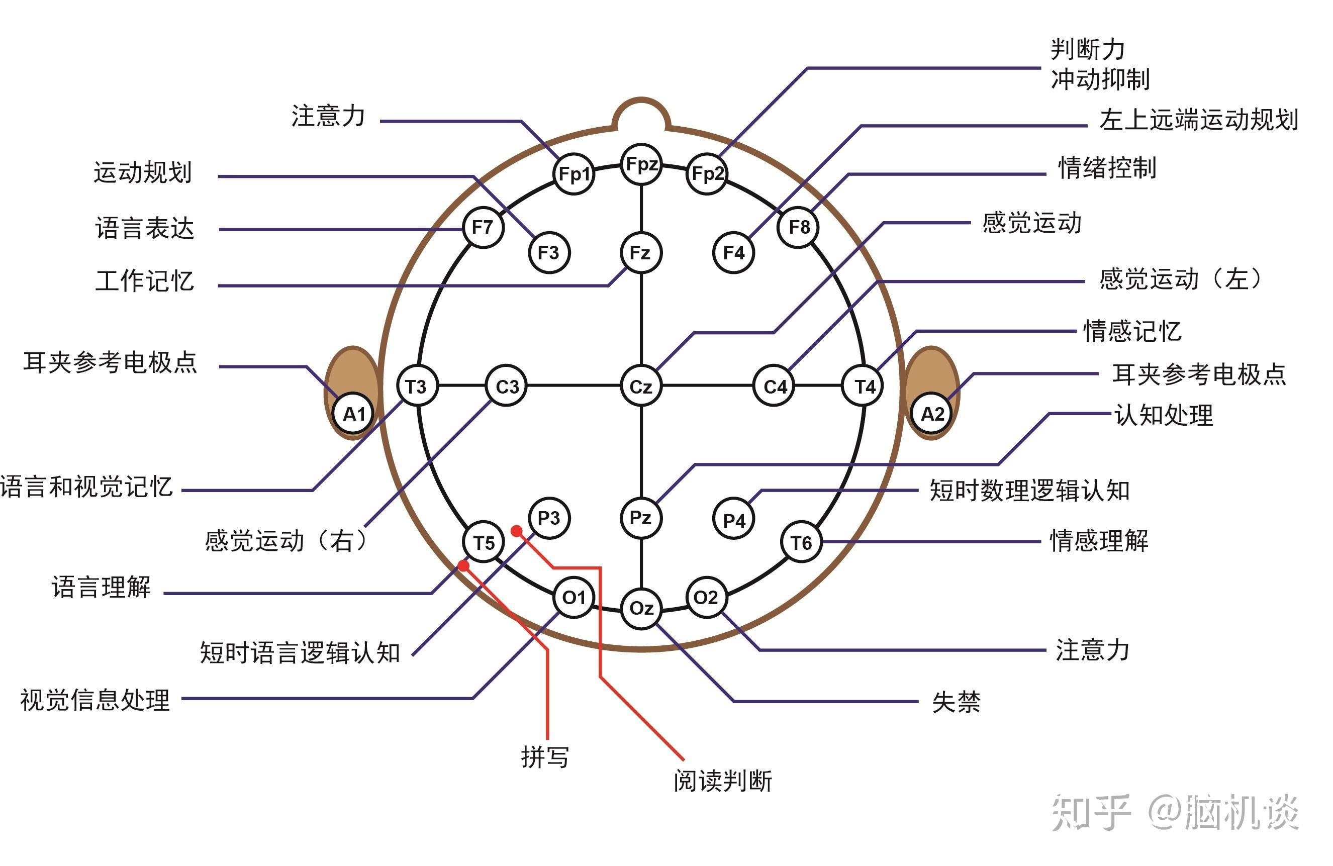 脑电图的定位方法图片