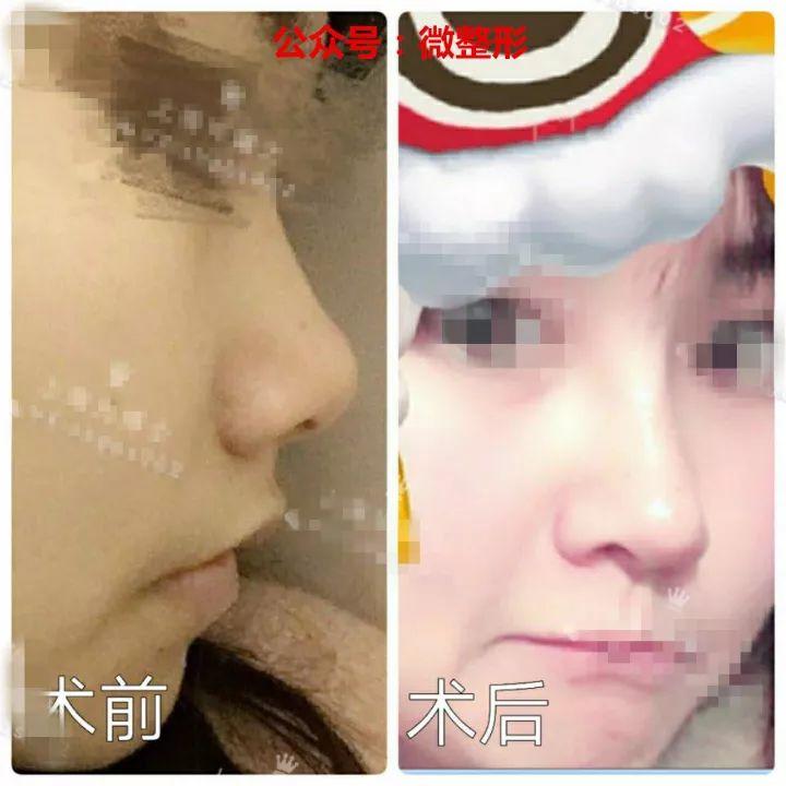 说自己的鼻子是纯天然的， 不信做个猪鼻子给你看看呀？ - 知乎