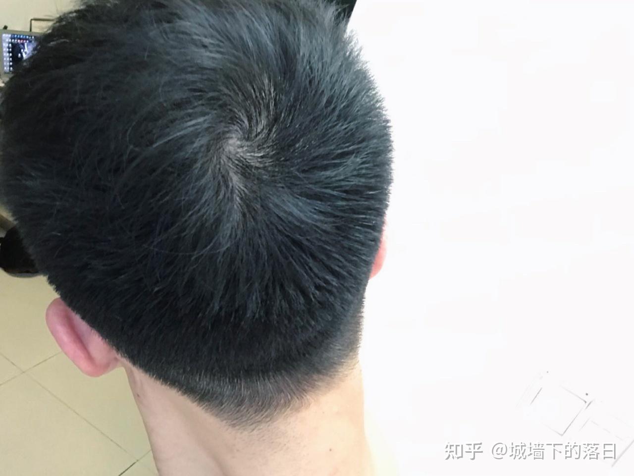 男生洗发水也有智商税?男生如何正确选择适合自己的洗发水