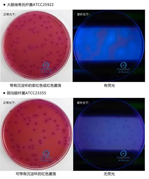 【菌周刊】大肠杆菌实验用常见培养基简述 知乎 