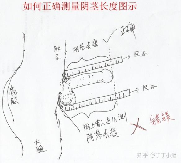 男生丁丁最大图解图片