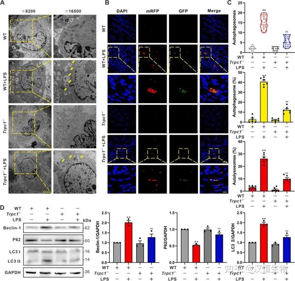 自噬干货分享系列之经典自噬研究 - 知乎