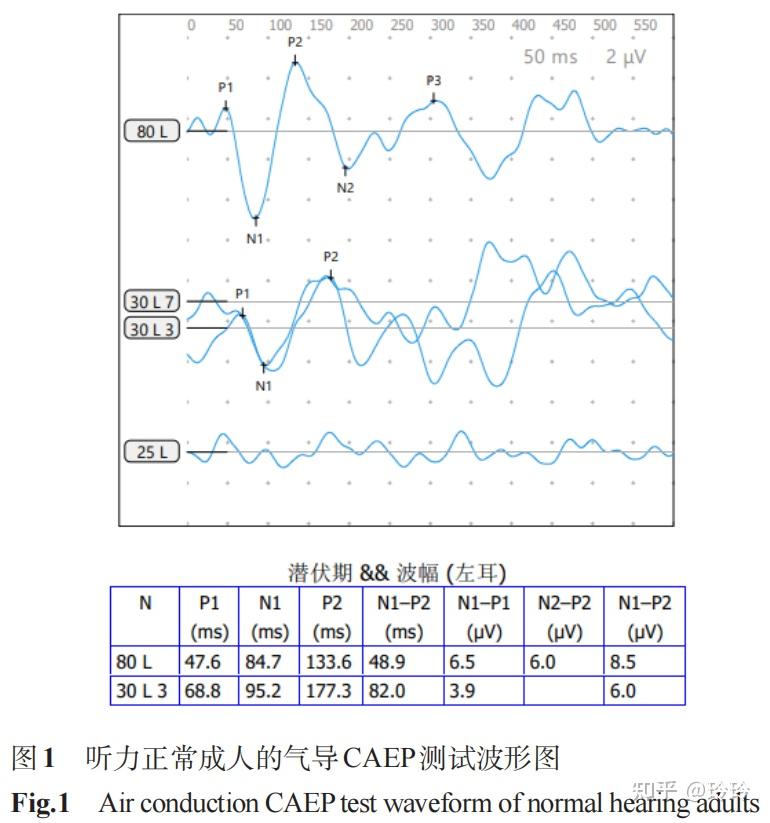 听觉皮层诱发电位在临床听力学诊断与干预中的应用进展！ - 知乎