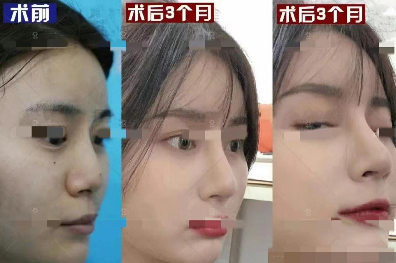 杏林医美：大火的“轮廓固定”？如何通过“微调”达到颜值飞跃？