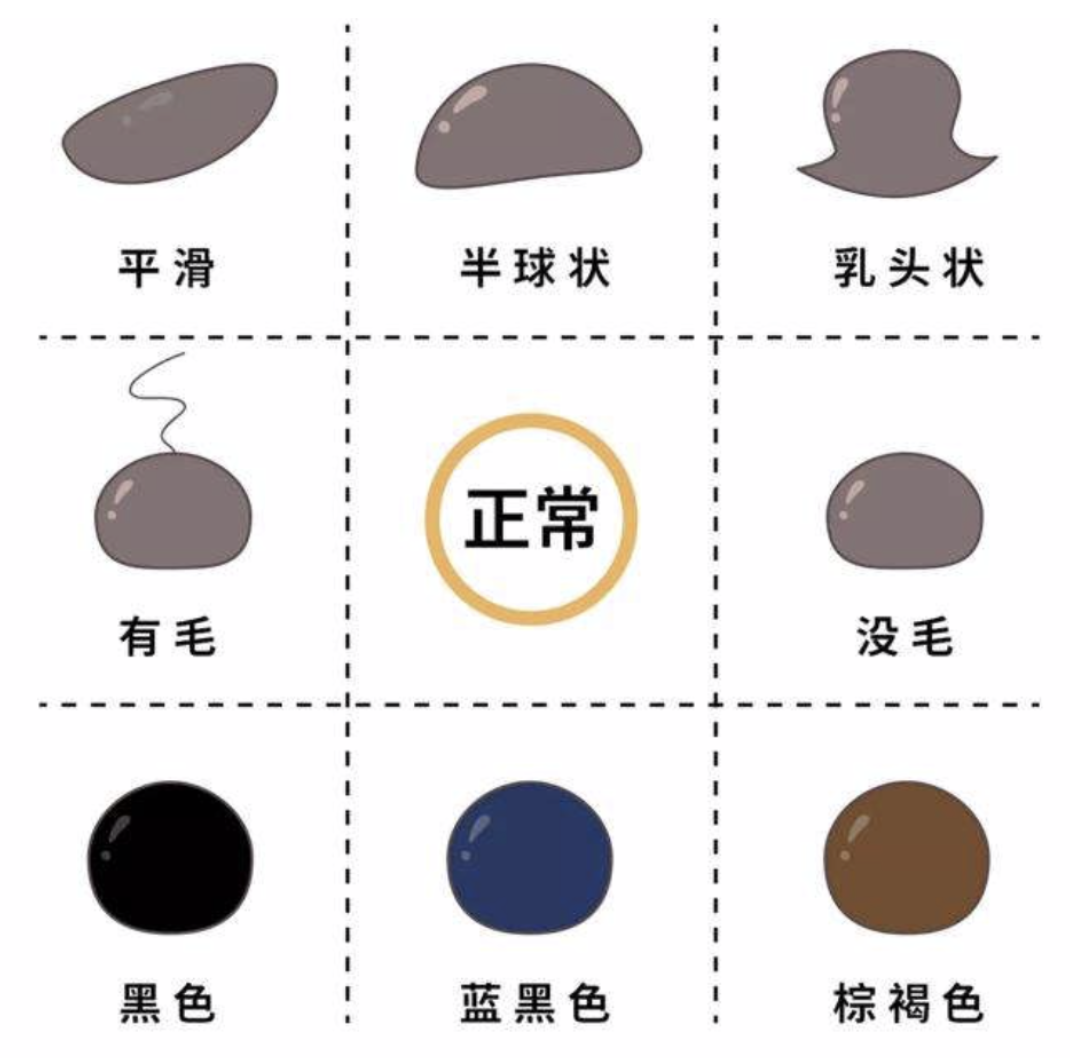 v2-2ce16ea583f896c5545a2ac01ecc069b_r.jpg