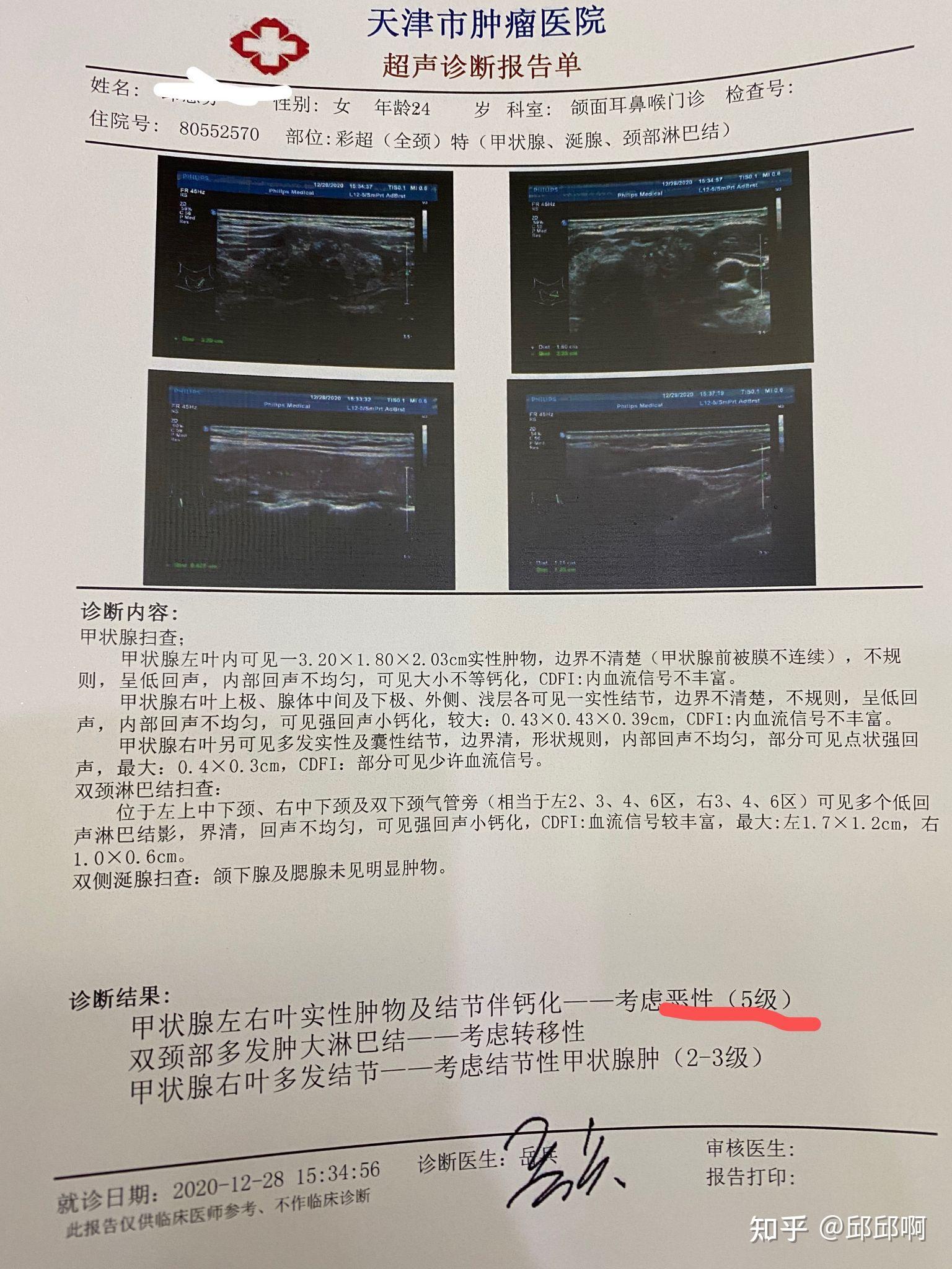 與甲狀腺癌不期而遇cancer你好本命年的最後一個黑色驚喜甲狀腺全切一