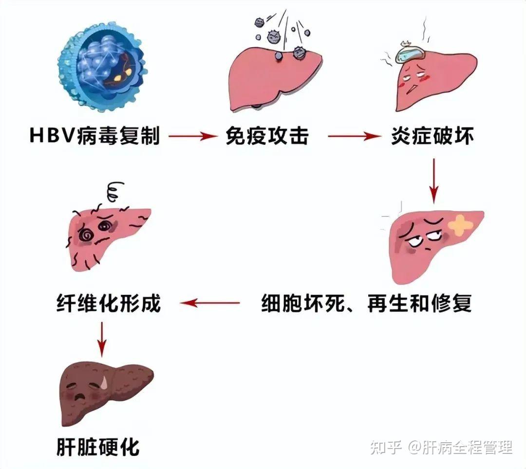 院士证明：干细胞可有效改善肝硬化