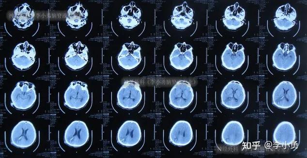 北京中醫(yī)院掛號指引CT加急-北京中醫(yī)院掛號指引ct加急核酸 