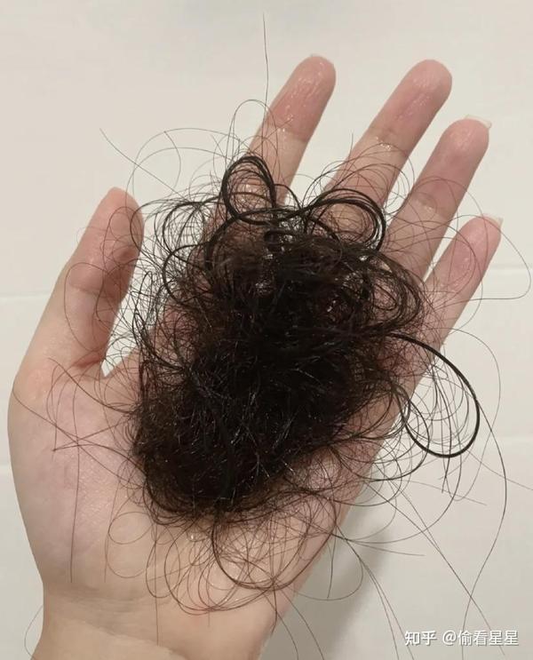 一,秃头女孩的救星