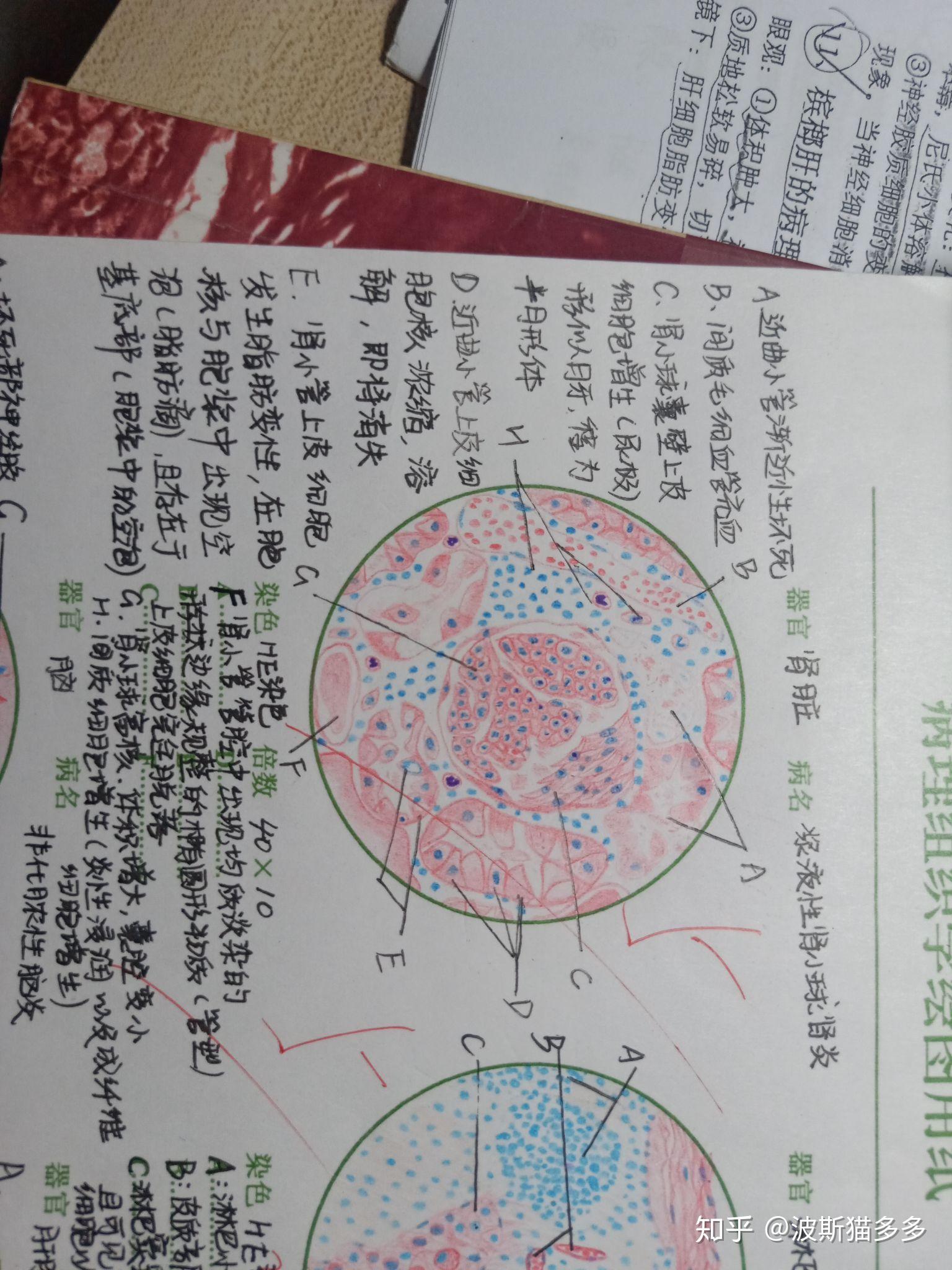 獸醫病理解剖學組織切片紅藍鉛畫圖展示