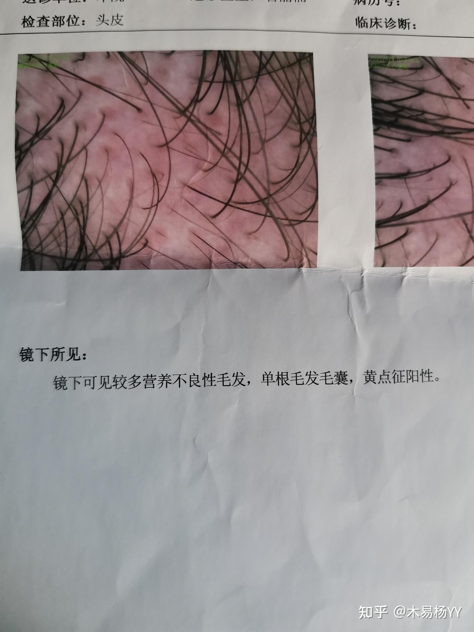 脱发挂号挂哪个科室(脱发挂号挂哪个科室比较好)