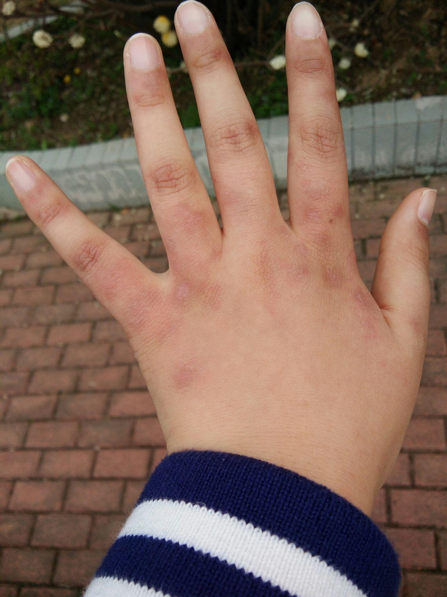 手难看成这样有办法变好看吗2121手指太粗总是显得手小减肥可以瘦