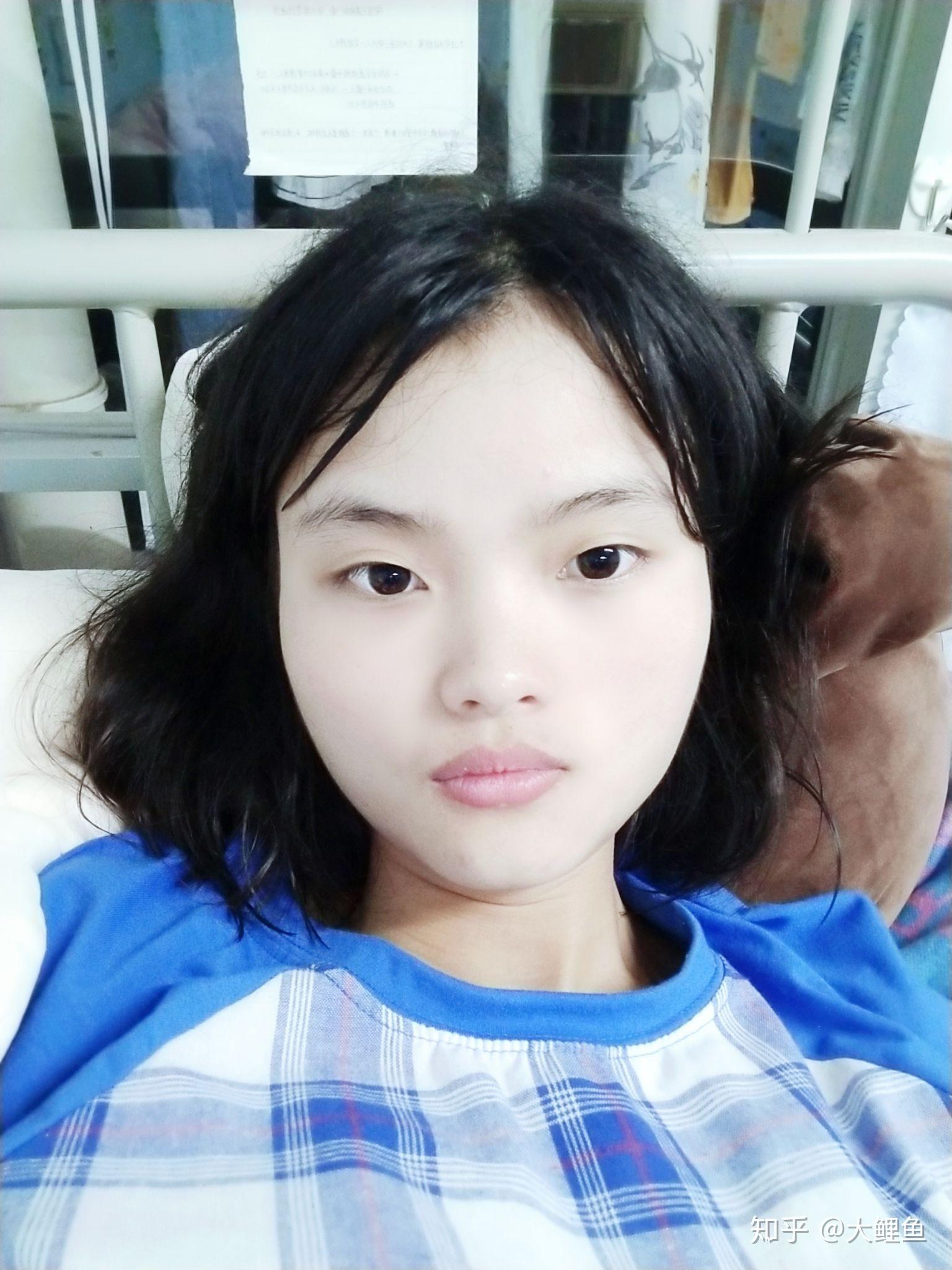 问一下对于一个近视的人，为什么近照五官更漂亮，脸小？远照就是一个大饼脸，而且眼睛好小