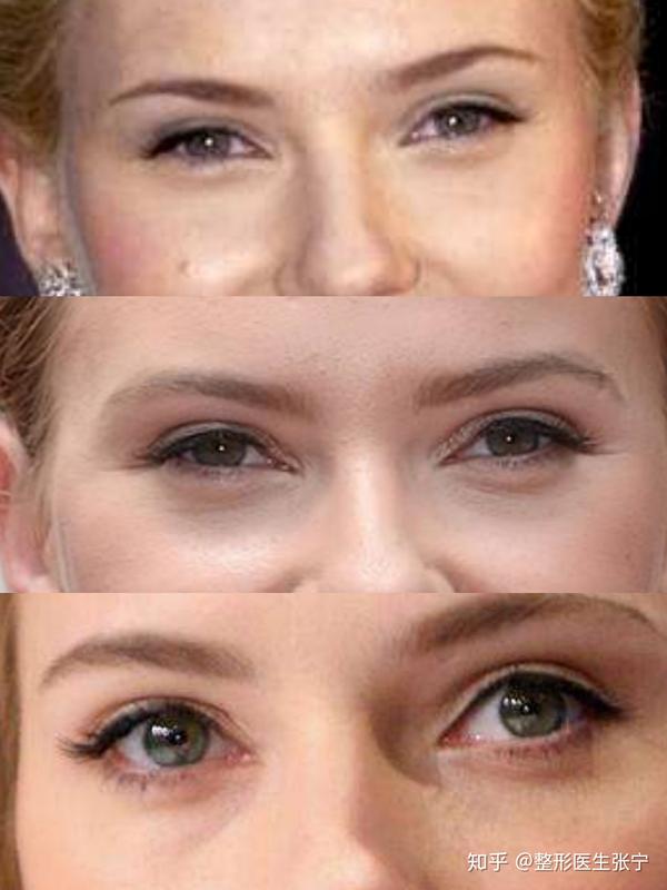 黑寡妇斯嘉丽最迷人的地方你知道吗