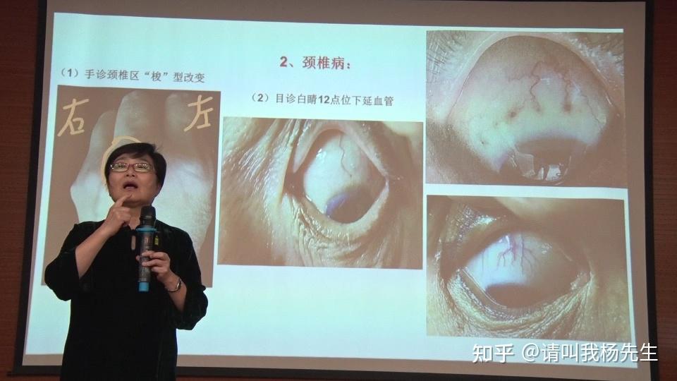看的懂学的会,综合望诊(手诊+面诊+舌诊+目诊+耳诊) - 知乎