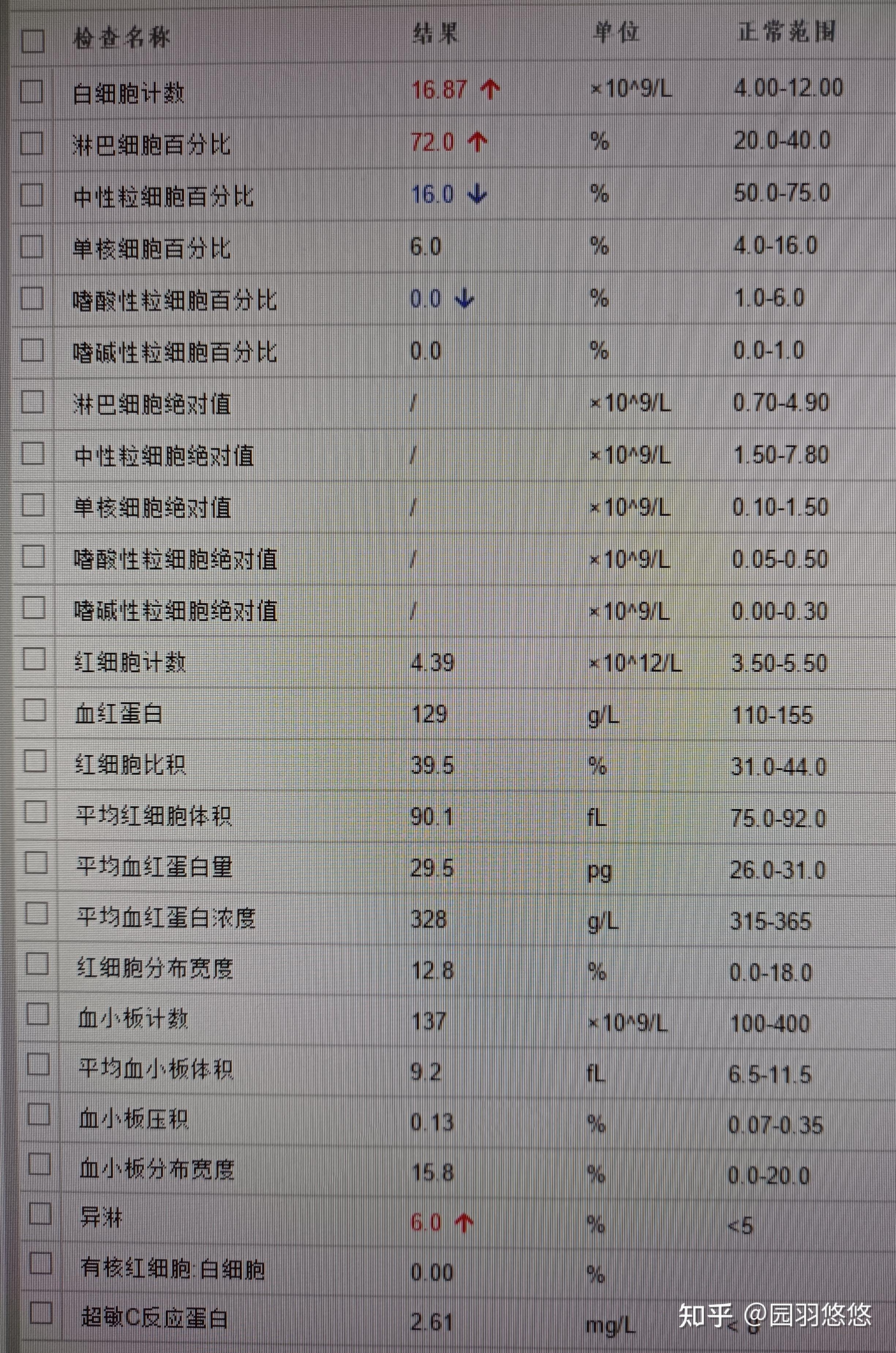 8岁男童,发热伴双眼睑肿1天:eb病毒感染 知乎