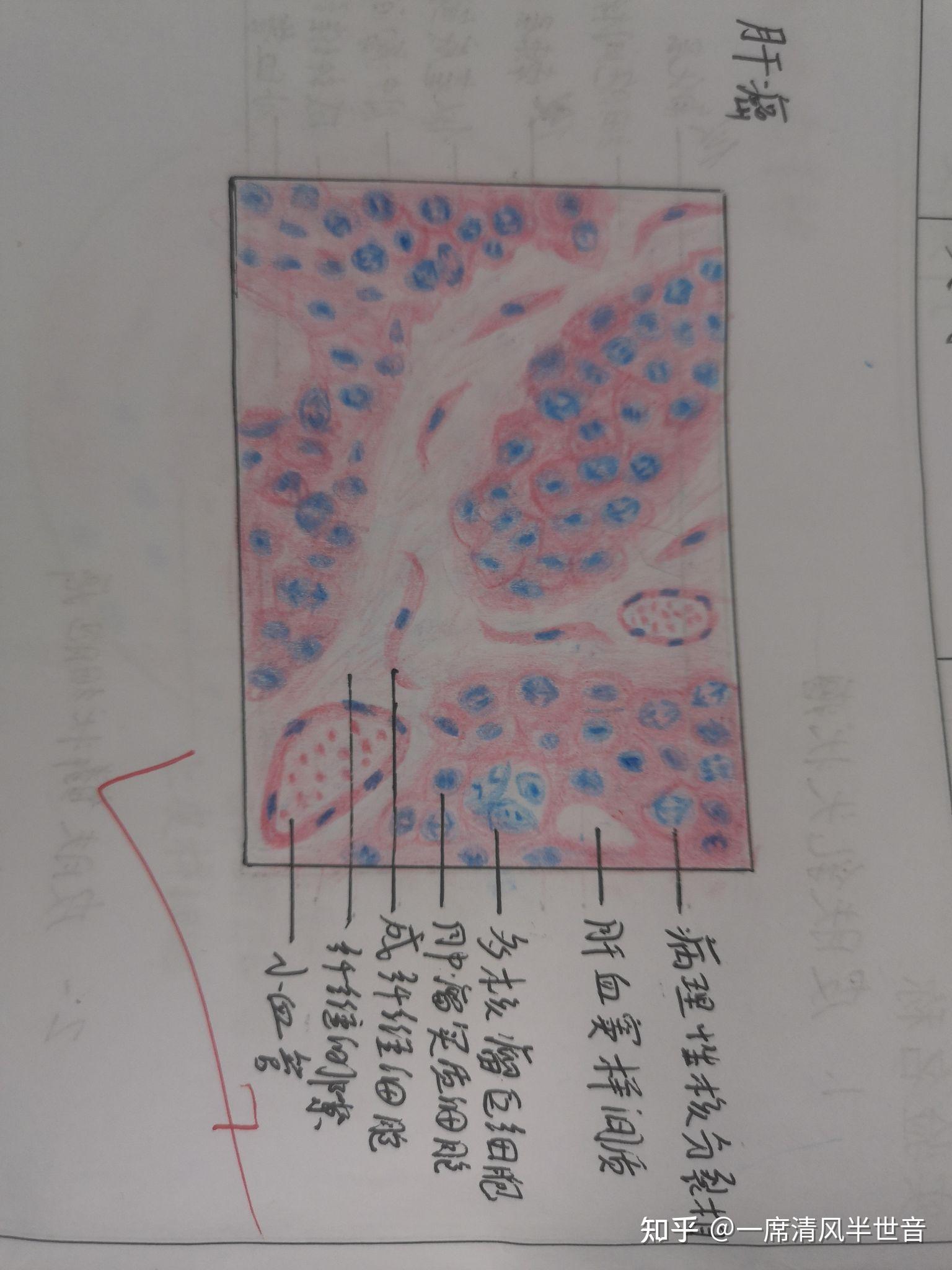 病理学实验报告红蓝铅笔手绘图