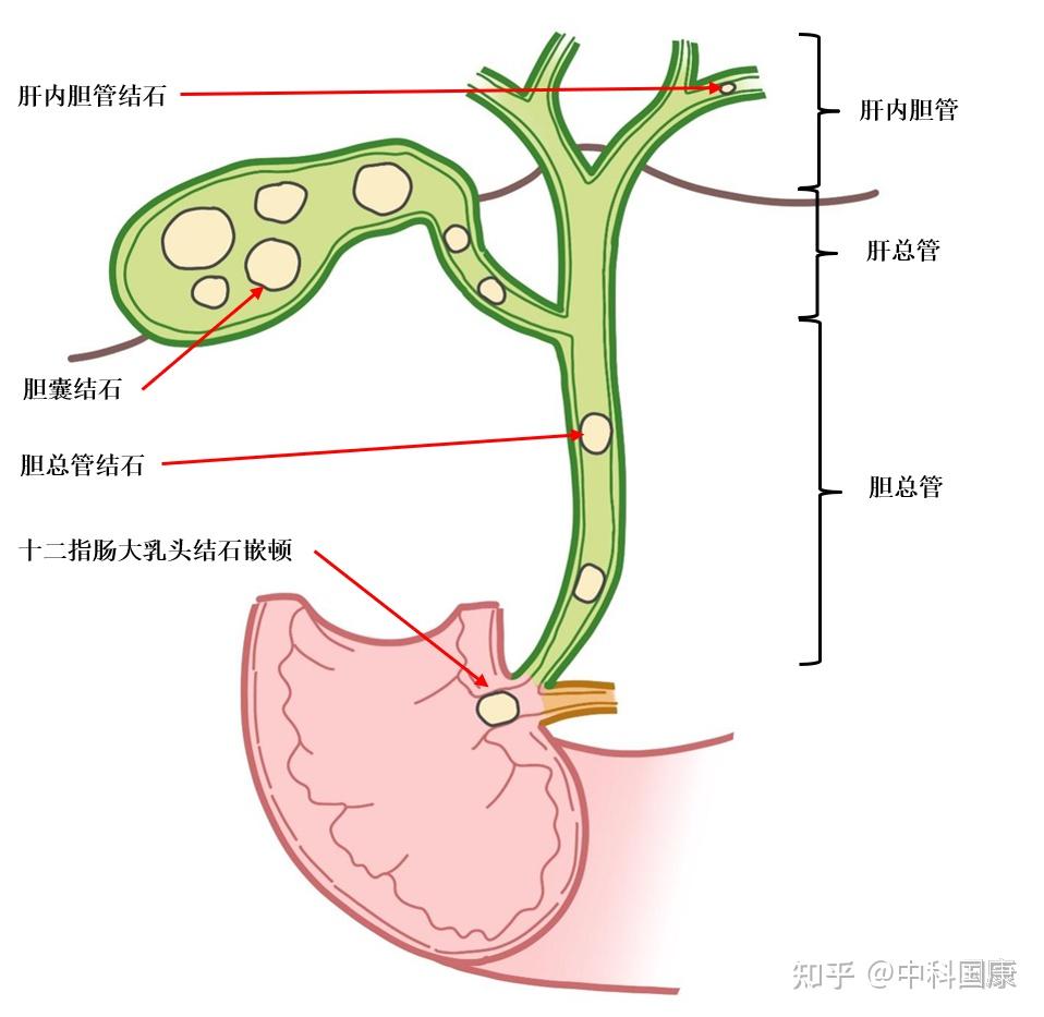 胆总管分为哪四段图片图片