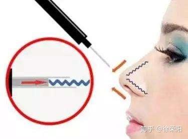 v2-2ec72e255f1429ea7beddd3bf73fc5b7_b.jpg