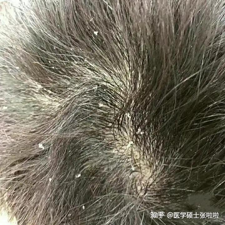 v2-2ece3d785613e5aef4e4af2049b60cff_r.jpg