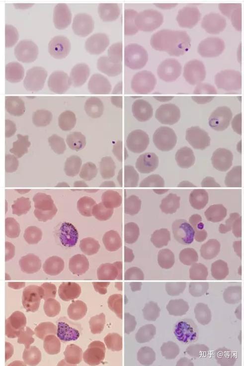 武松和青蒿素浅谈疟疾
