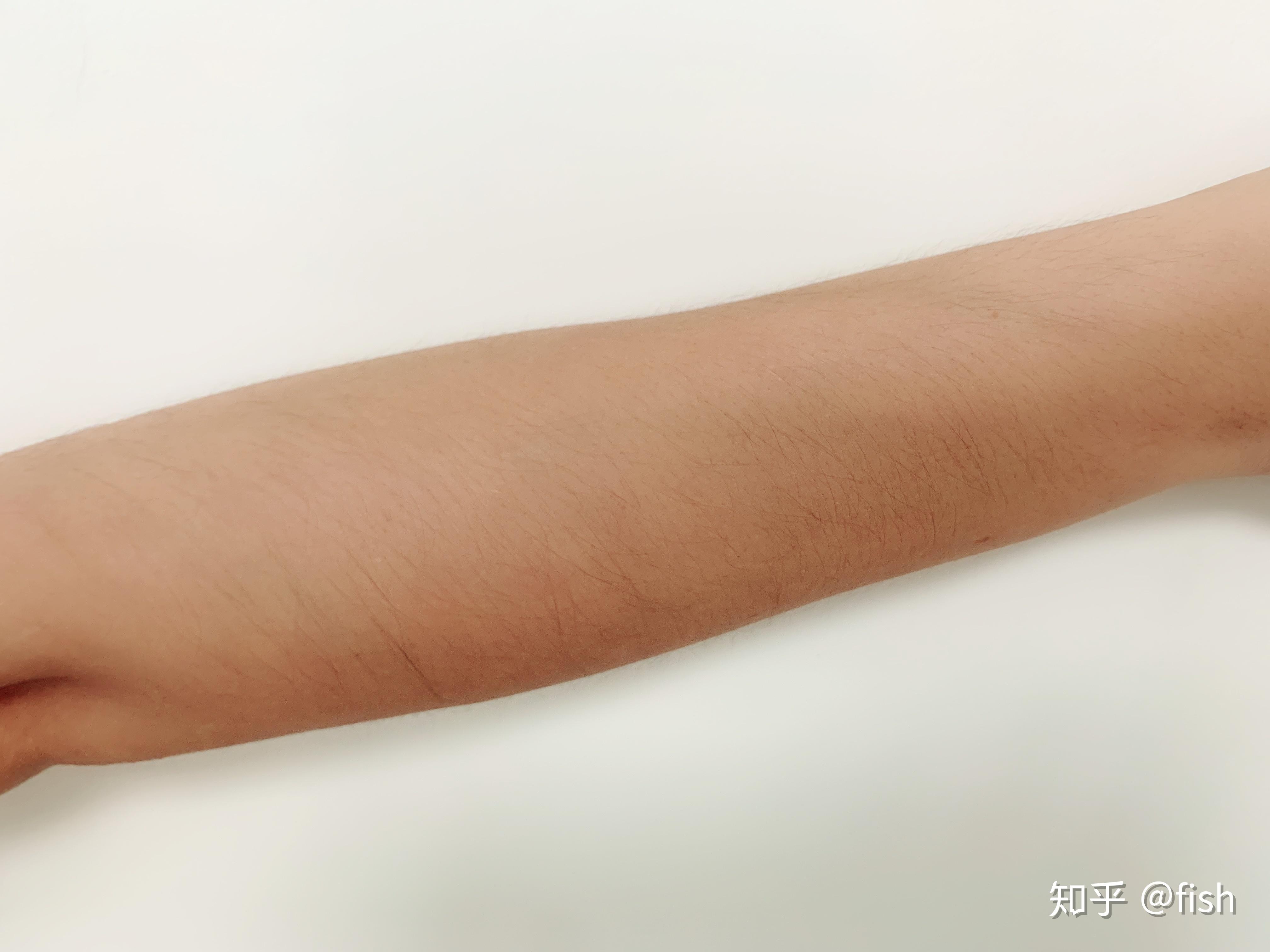 脱毛排名_脱毛对比图(3)