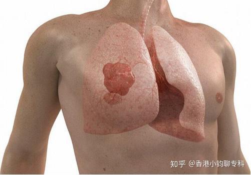 身体各部位器官可能出现的不良症状及原因 知乎