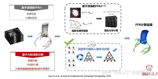 血流储备分数2——一文了解，FFR、FFRct技术原理、特点及应用 - 知乎