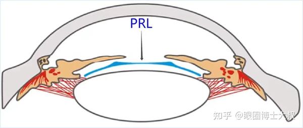 Prl Observatory PRL近视手术是什么? - 知乎